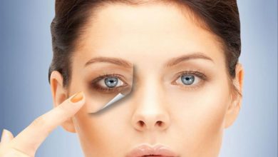 الهالات السوداء